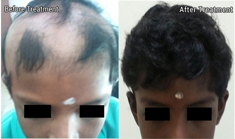 Hair Treatment In Chennai  Relookingindiacom by Relooking india  Issuu